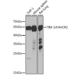 Western Blot - Anti-TIM 3 Antibody (A89282) - Antibodies.com