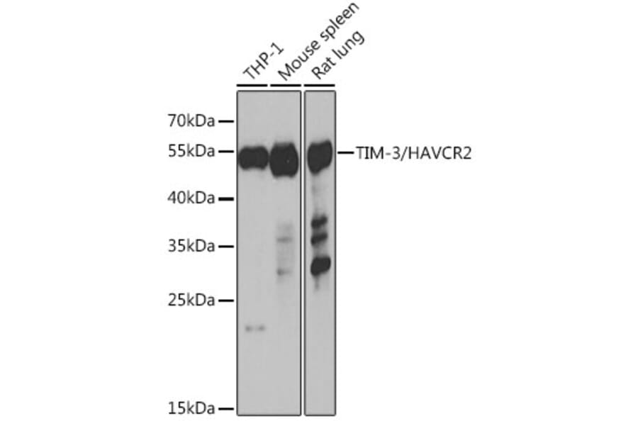 Western Blot - Anti-TIM 3 Antibody (A89282) - Antibodies.com
