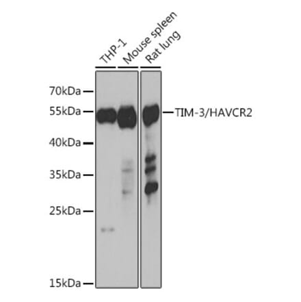 Western Blot - Anti-TIM 3 Antibody (A89282) - Antibodies.com