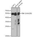 Western Blot - Anti-TIM 3 Antibody (A89282) - Antibodies.com