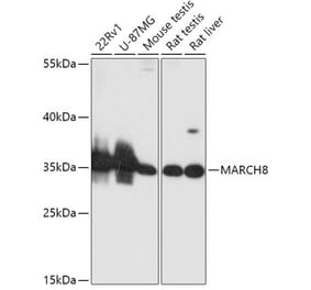 Western Blot - Anti-MARCHF8 Antibody (A89283) - Antibodies.com