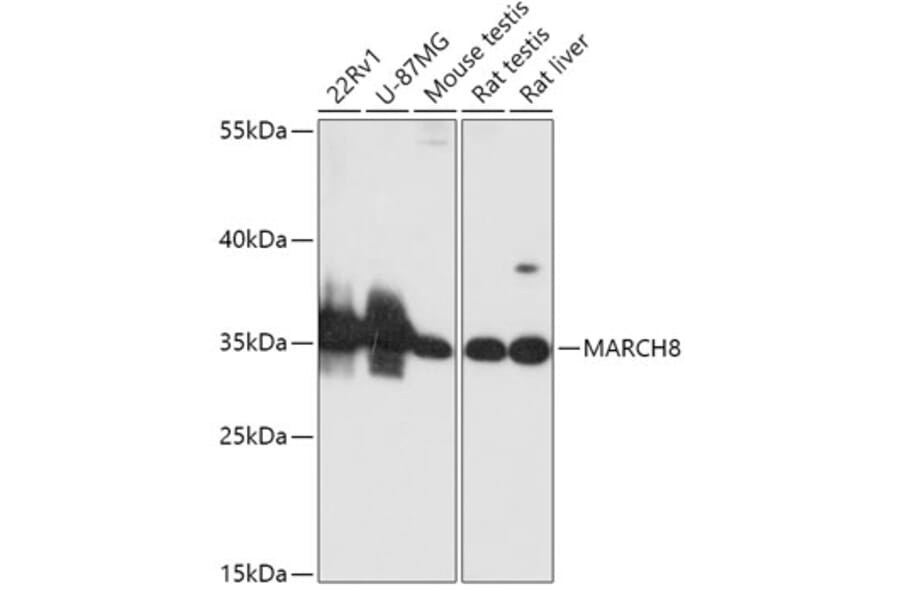 Western Blot - Anti-MARCHF8 Antibody (A89283) - Antibodies.com