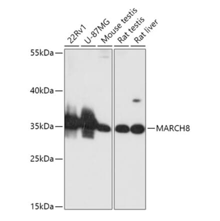 Western Blot - Anti-MARCHF8 Antibody (A89283) - Antibodies.com