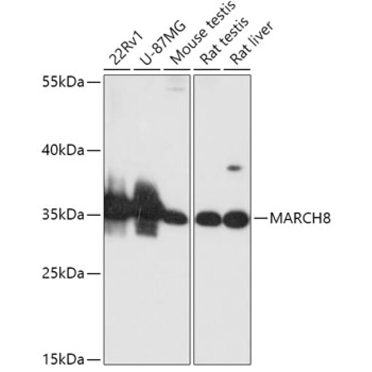 Western Blot - Anti-MARCHF8 Antibody (A89283) - Antibodies.com