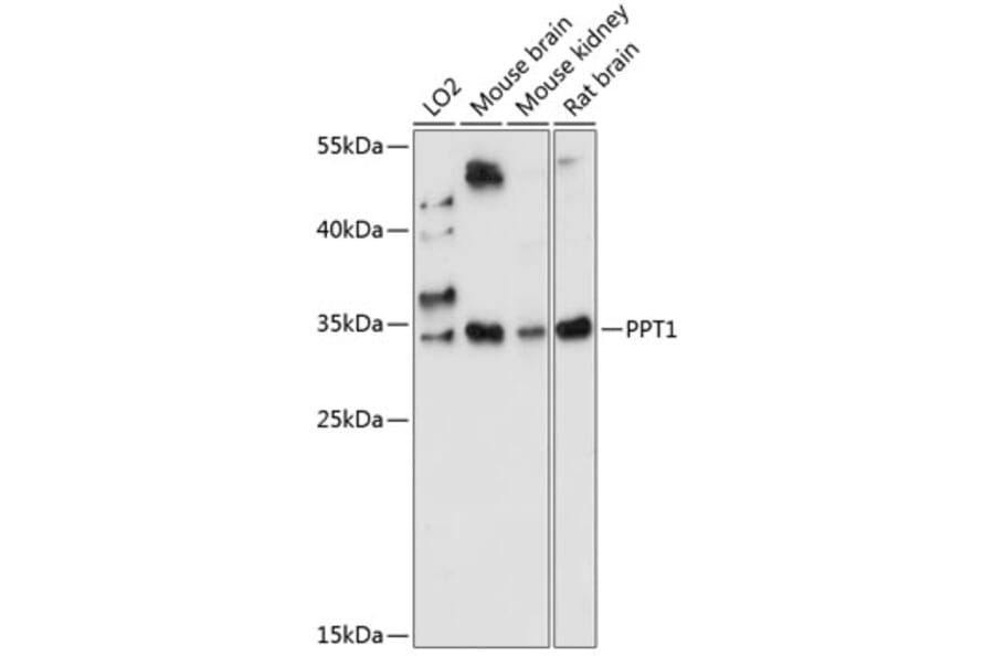Western Blot - Anti-PPT1/PPT Antibody (A89284) - Antibodies.com