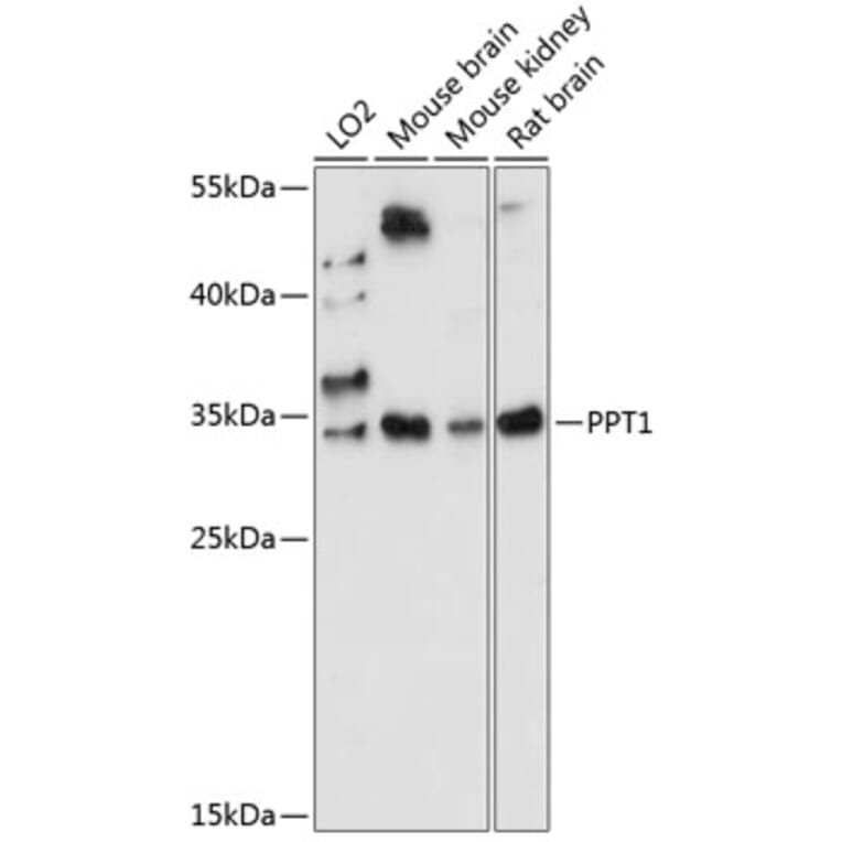 Western Blot - Anti-PPT1/PPT Antibody (A89284) - Antibodies.com