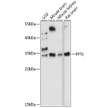 Western Blot - Anti-PPT1/PPT Antibody (A89284) - Antibodies.com