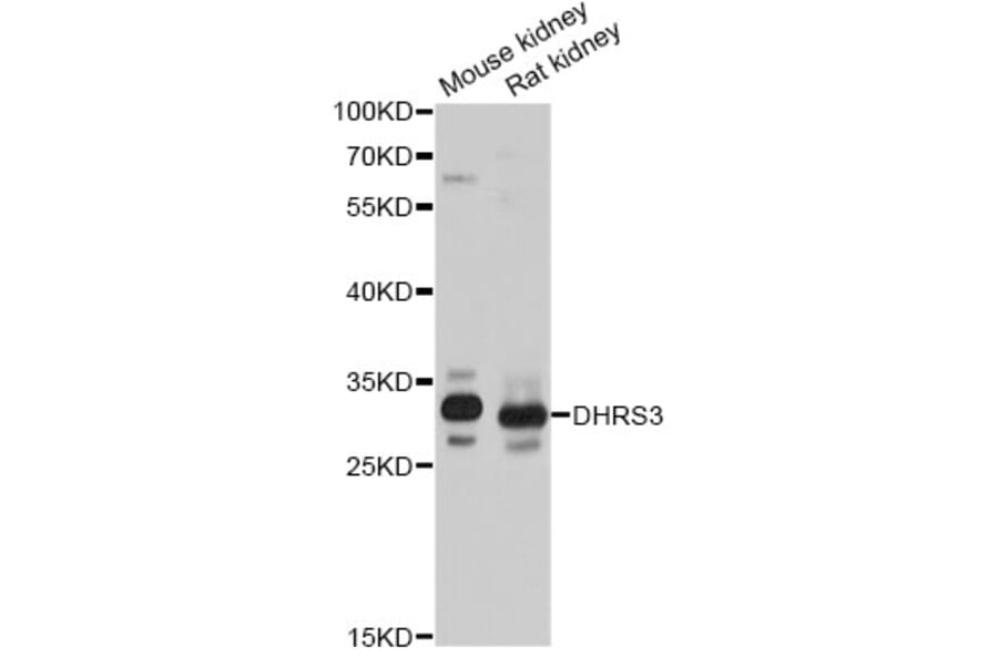 Western Blot - Anti-DHRS3 Antibody (A14172) - Antibodies.com