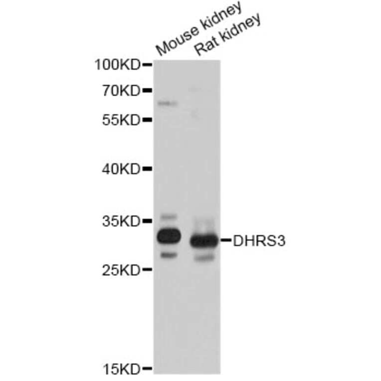 Western Blot - Anti-DHRS3 Antibody (A14172) - Antibodies.com