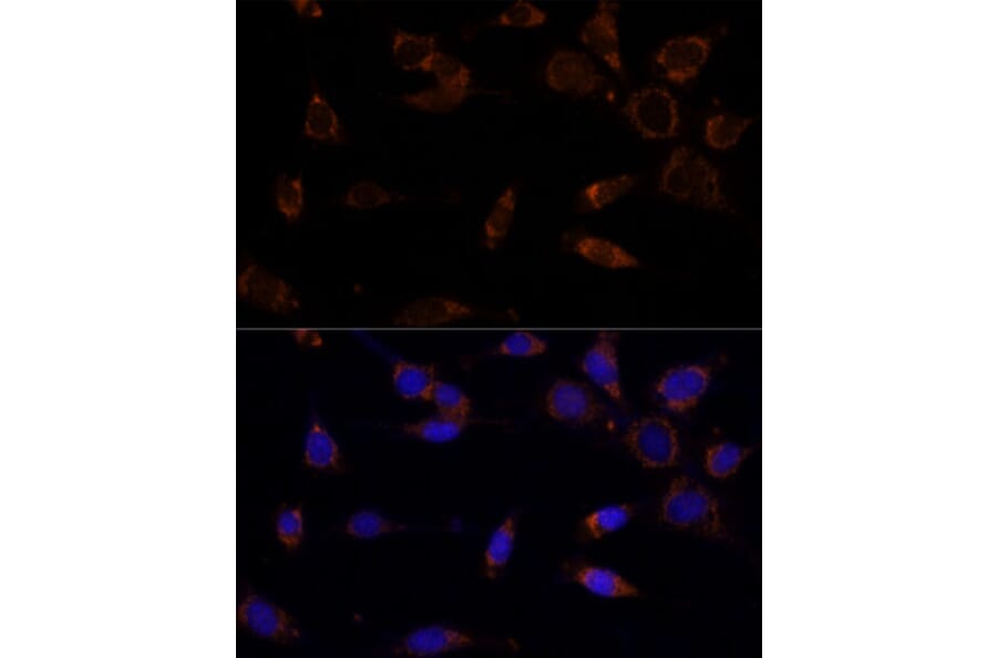 Immunofluorescence - Anti-MTCH2 Antibody (A89286) - Antibodies.com