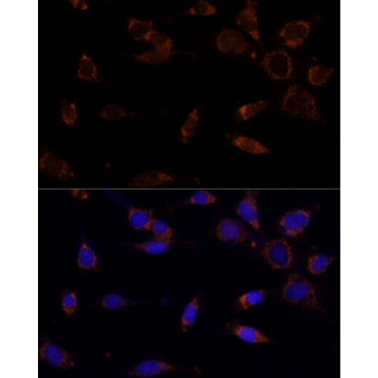 Immunofluorescence - Anti-MTCH2 Antibody (A89286) - Antibodies.com