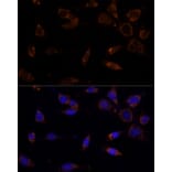 Immunofluorescence - Anti-MTCH2 Antibody (A89286) - Antibodies.com