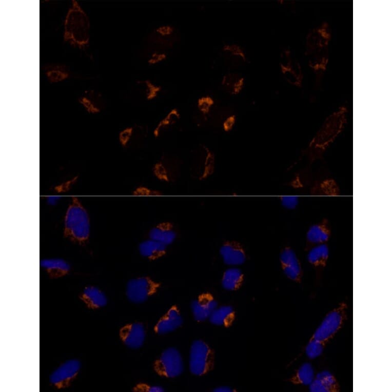 Immunofluorescence - Anti-MTCH2 Antibody (A89286) - Antibodies.com