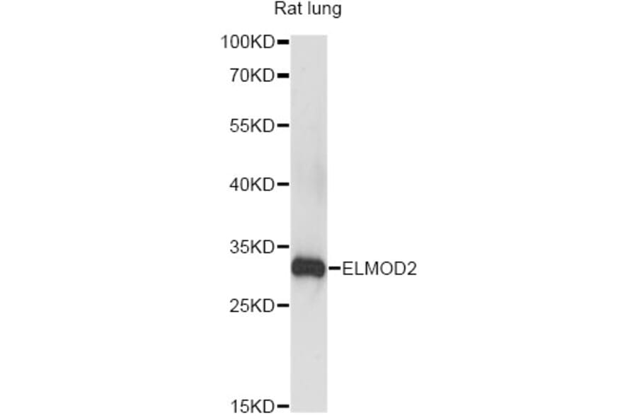 Western Blot - Anti-ELMOD2 Antibody (A14524) - Antibodies.com