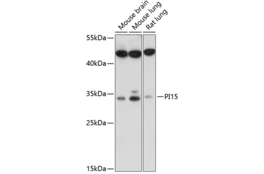 Western Blot - Anti-PI-15 Antibody (A89290) - Antibodies.com