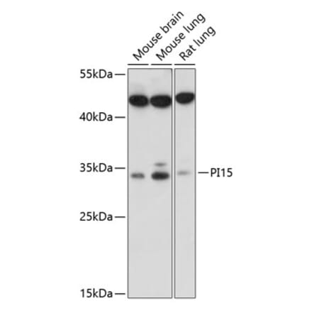 Western Blot - Anti-PI-15 Antibody (A89290) - Antibodies.com