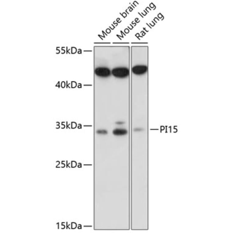 Western Blot - Anti-PI-15 Antibody (A89290) - Antibodies.com