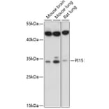 Western Blot - Anti-PI-15 Antibody (A89290) - Antibodies.com