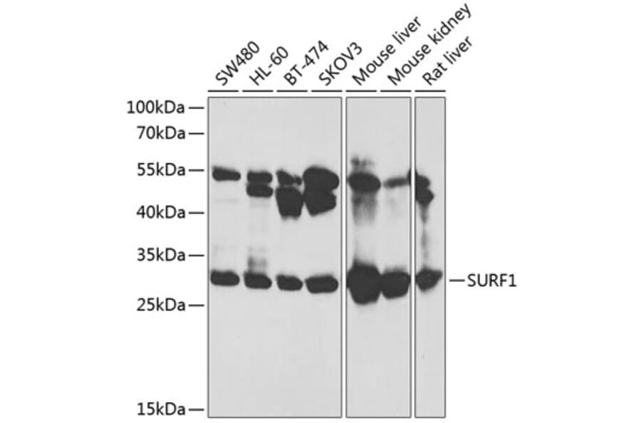 Western Blot - Anti-SURF1 Antibody (A12521) - Antibodies.com
