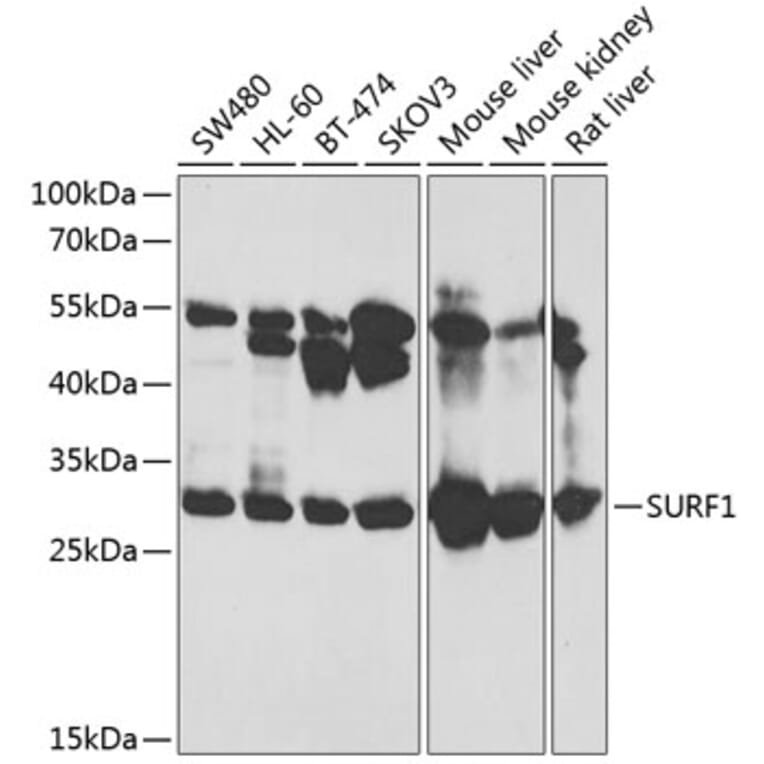 Western Blot - Anti-SURF1 Antibody (A12521) - Antibodies.com