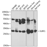 Western Blot - Anti-SURF1 Antibody (A12521) - Antibodies.com