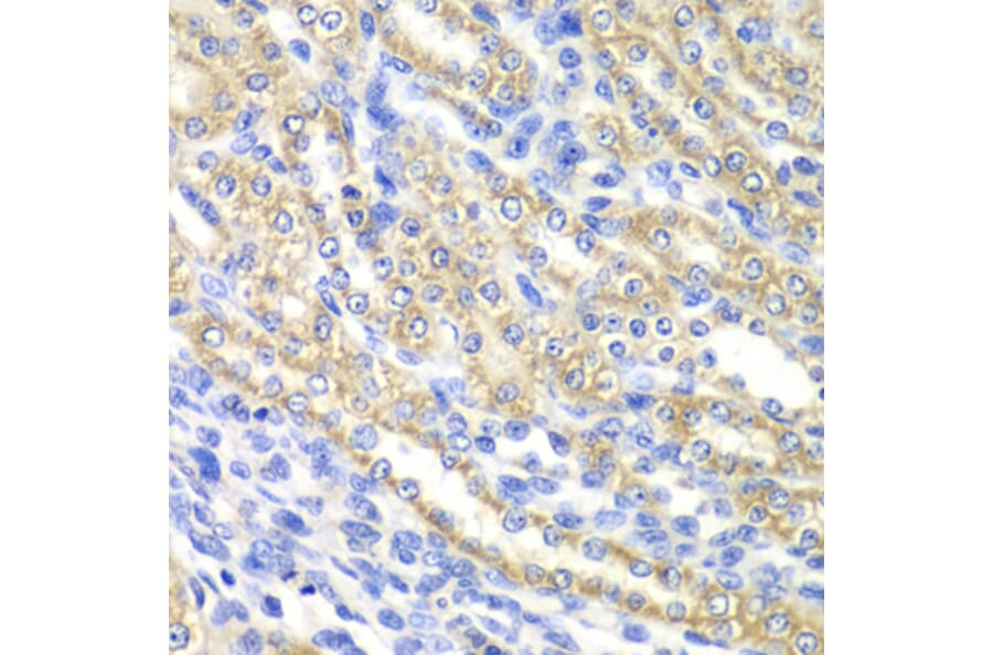 Immunohistochemistry - Anti-SURF1 Antibody (A12521) - Antibodies.com