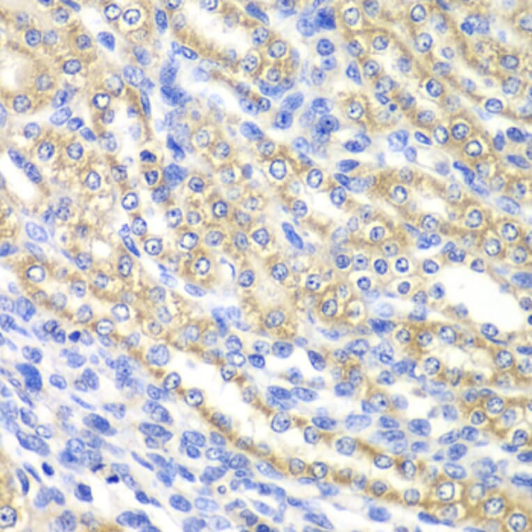 Immunohistochemistry - Anti-SURF1 Antibody (A12521) - Antibodies.com