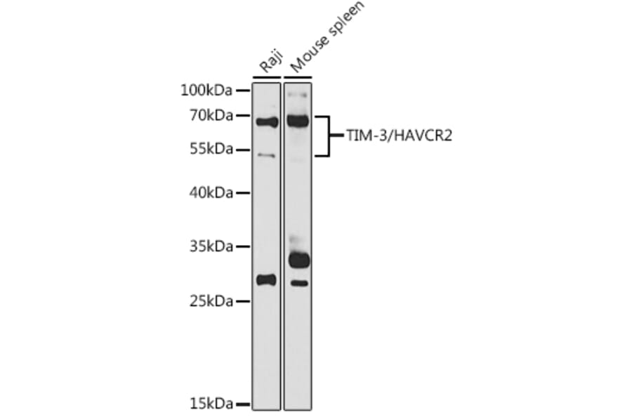 Western Blot - Anti-TIM 3 Antibody (A89292) - Antibodies.com