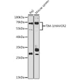 Western Blot - Anti-TIM 3 Antibody (A89292) - Antibodies.com