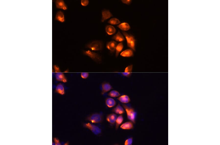 Immunofluorescence - Anti-TIM 3 Antibody (A89292) - Antibodies.com