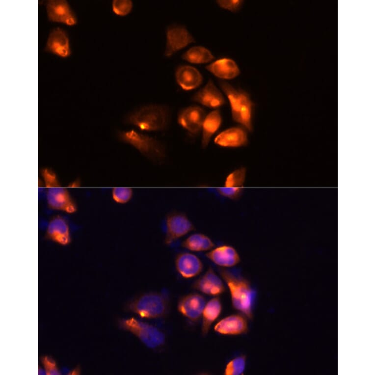 Immunofluorescence - Anti-TIM 3 Antibody (A89292) - Antibodies.com