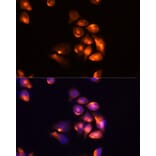 Immunofluorescence - Anti-TIM 3 Antibody (A89292) - Antibodies.com