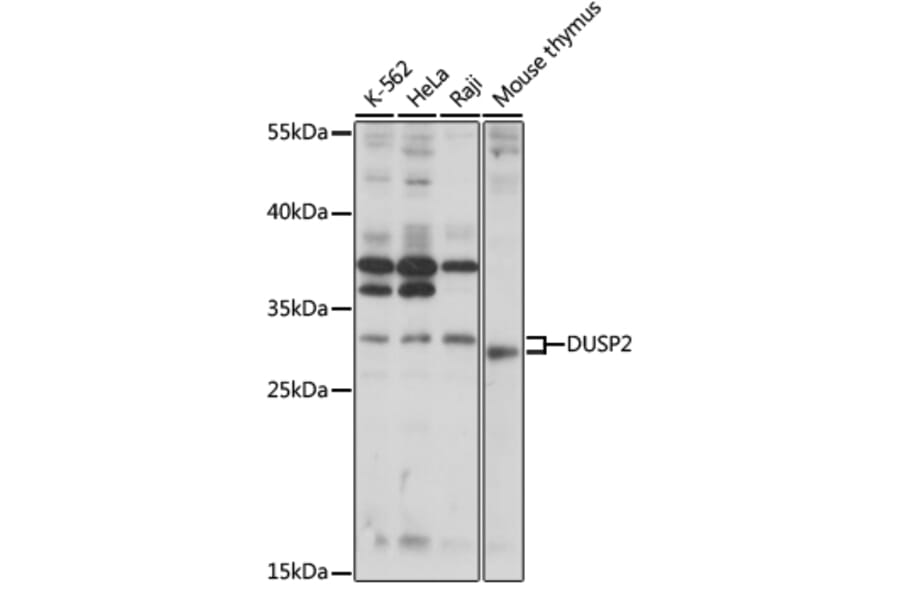 Western Blot - Anti-DUSP2 Antibody (A89293) - Antibodies.com