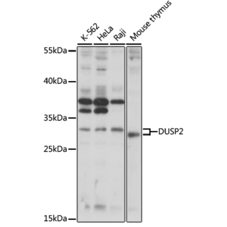 Western Blot - Anti-DUSP2 Antibody (A89293) - Antibodies.com