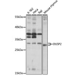 Western Blot - Anti-DUSP2 Antibody (A89293) - Antibodies.com