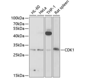 Western Blot - Anti-CDK1 Antibody (A89294) - Antibodies.com