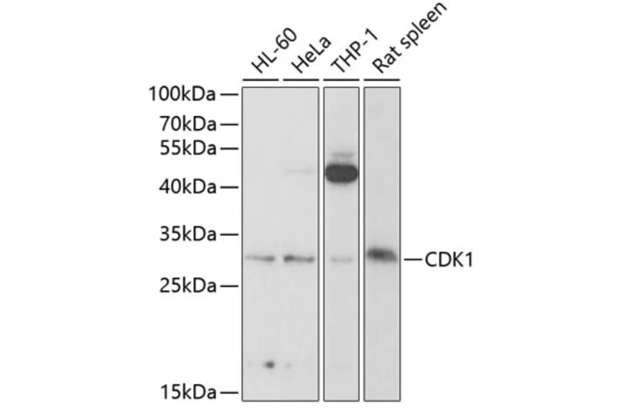 Western Blot - Anti-CDK1 Antibody (A89294) - Antibodies.com