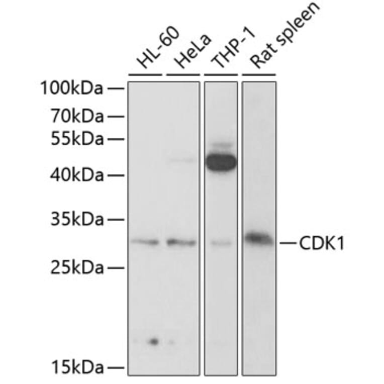 Western Blot - Anti-CDK1 Antibody (A89294) - Antibodies.com