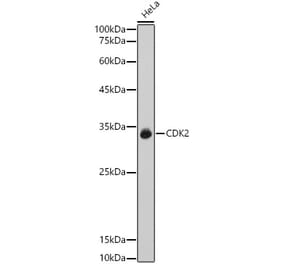 Western Blot - Anti-CDK2 Antibody (A89295) - Antibodies.com