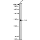 Western Blot - Anti-CDK2 Antibody (A89295) - Antibodies.com