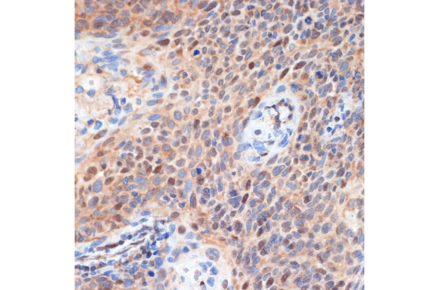 Immunohistochemistry - Anti-CDK2 Antibody (A89295) - Antibodies.com