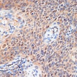 Immunohistochemistry - Anti-CDK2 Antibody (A89295) - Antibodies.com