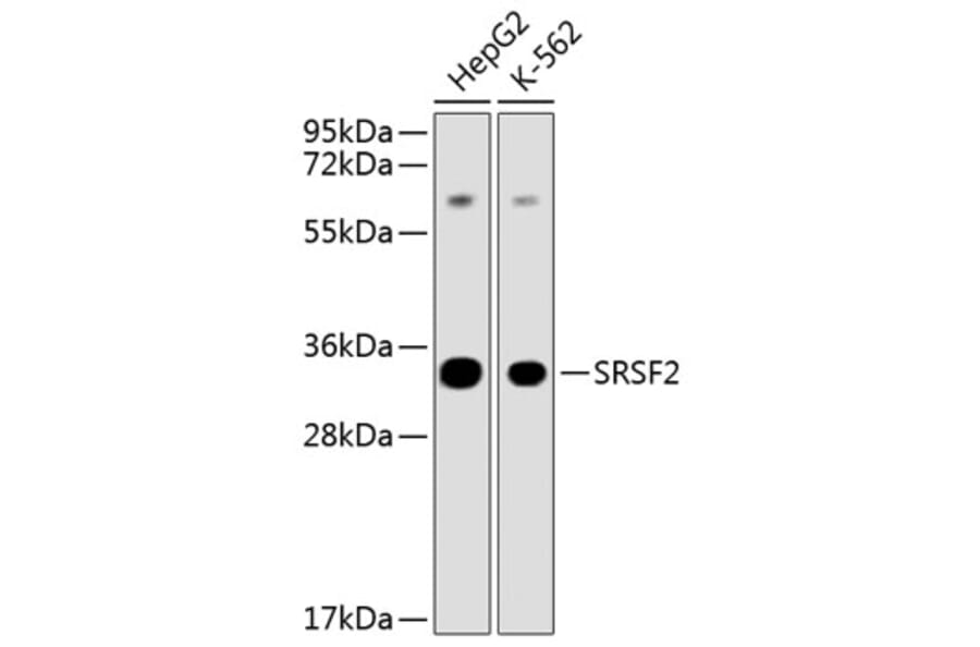 Western Blot - Anti-SFRS2 Antibody (A12625) - Antibodies.com