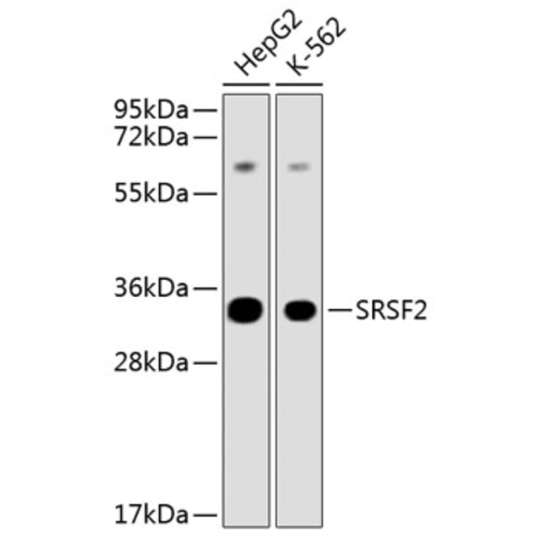 Western Blot - Anti-SFRS2 Antibody (A12625) - Antibodies.com