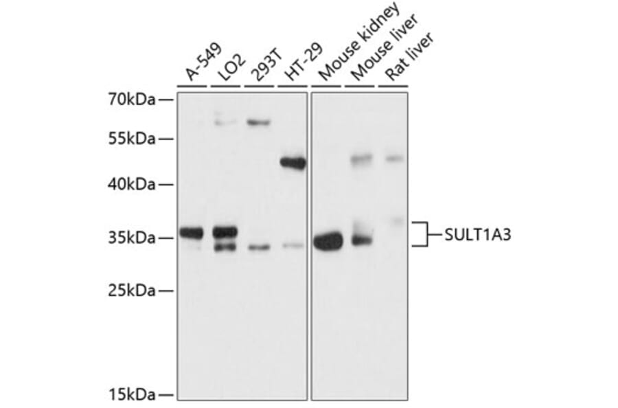 Western Blot - Anti-CSPS/STM Antibody (A89299) - Antibodies.com