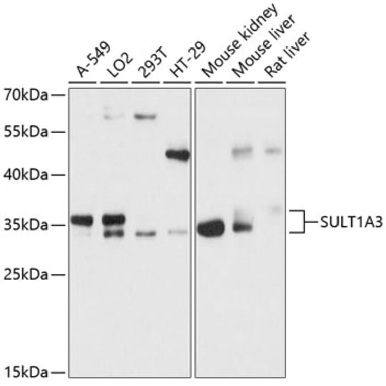 Western Blot - Anti-CSPS/STM Antibody (A89299) - Antibodies.com