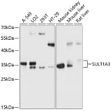 Western Blot - Anti-CSPS/STM Antibody (A89299) - Antibodies.com