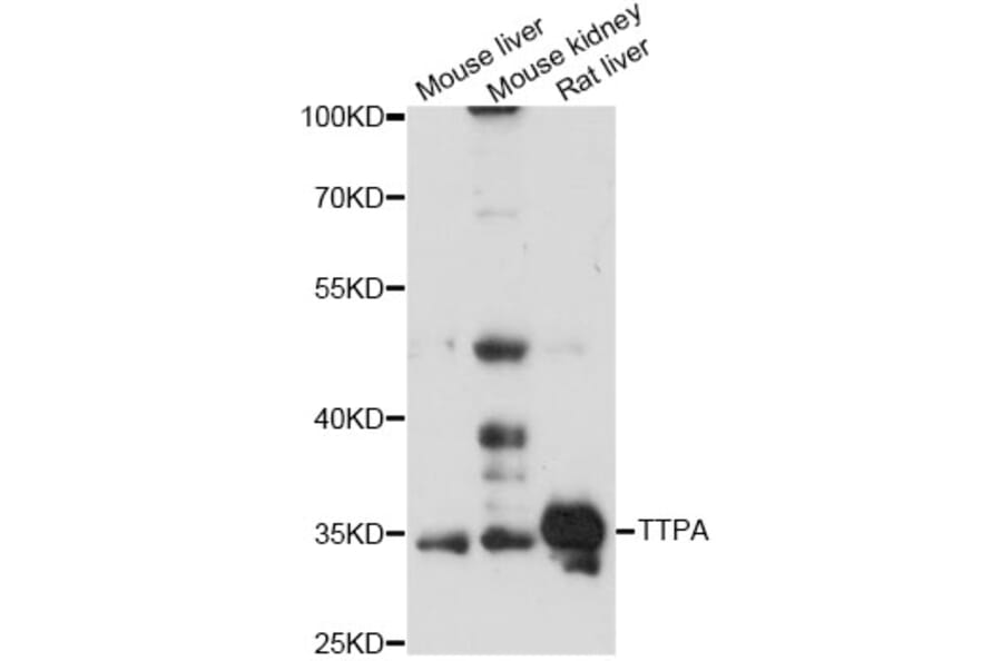 Western Blot - Anti-TTPA Antibody (A14473) - Antibodies.com