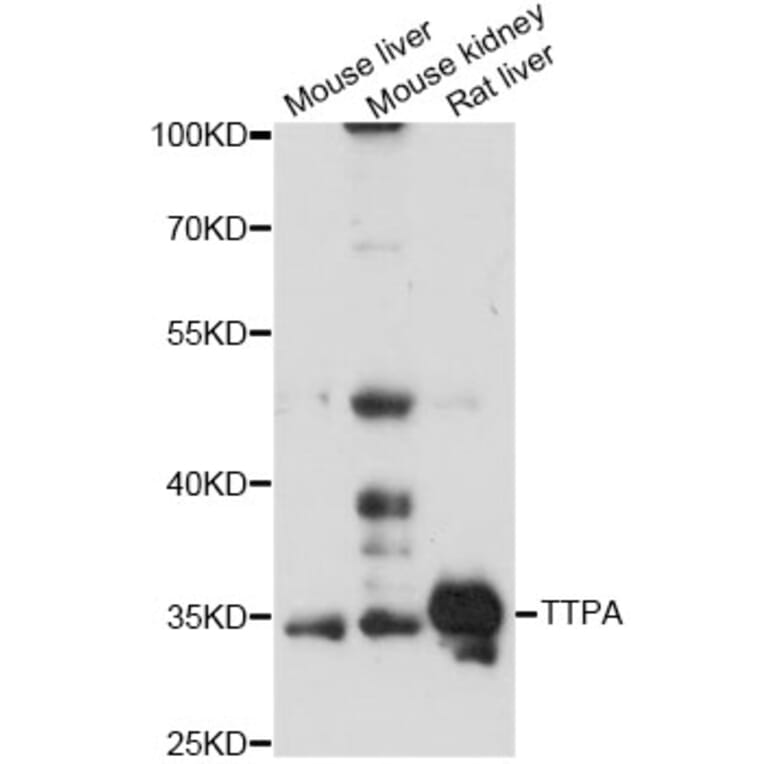 Western Blot - Anti-TTPA Antibody (A14473) - Antibodies.com