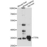 Western Blot - Anti-TTPA Antibody (A14473) - Antibodies.com